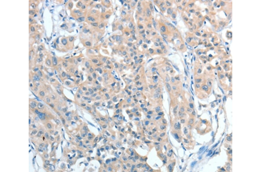 Immunohistochemistry - AGBL2 Antibody from Signalway Antibody (36058) - Antibodies.com