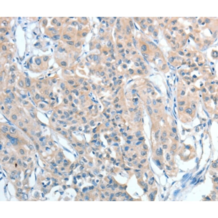 Immunohistochemistry - AGBL2 Antibody from Signalway Antibody (36058) - Antibodies.com