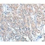 Immunohistochemistry - AGBL2 Antibody from Signalway Antibody (36058) - Antibodies.com