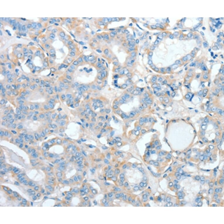 Immunohistochemistry - AGBL2 Antibody from Signalway Antibody (36058) - Antibodies.com