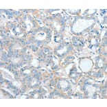 Immunohistochemistry - AGBL2 Antibody from Signalway Antibody (36058) - Antibodies.com