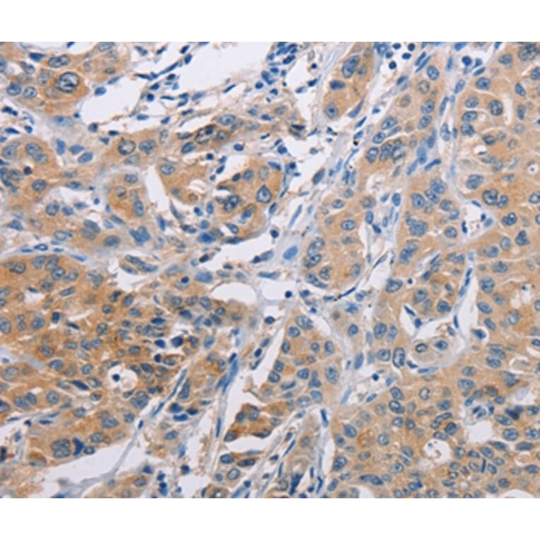 Immunohistochemistry - AGBL5 Antibody from Signalway Antibody (36059) - Antibodies.com