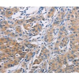 Immunohistochemistry - AGBL5 Antibody from Signalway Antibody (36059) - Antibodies.com
