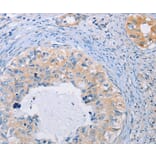 Immunohistochemistry - AGBL5 Antibody from Signalway Antibody (36059) - Antibodies.com