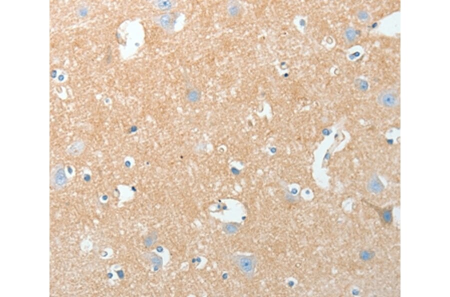 Immunohistochemistry - AKAP7 Antibody from Signalway Antibody (36067) - Antibodies.com