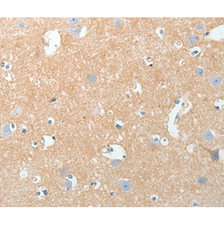 Immunohistochemistry - AKAP7 Antibody from Signalway Antibody (36067) - Antibodies.com