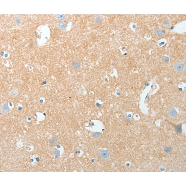 Immunohistochemistry - AKAP7 Antibody from Signalway Antibody (36067) - Antibodies.com