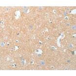 Immunohistochemistry - AKAP7 Antibody from Signalway Antibody (36067) - Antibodies.com