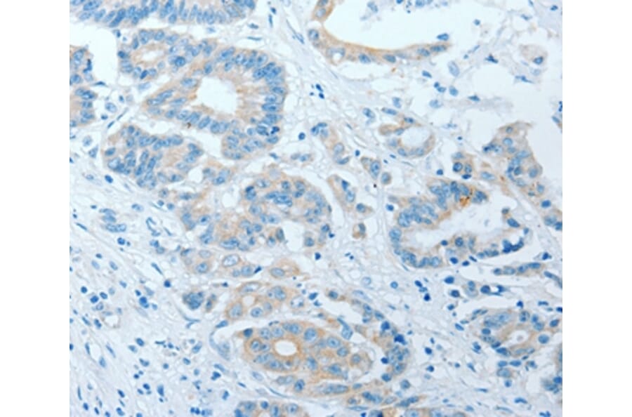 Immunohistochemistry - AKAP7 Antibody from Signalway Antibody (36067) - Antibodies.com