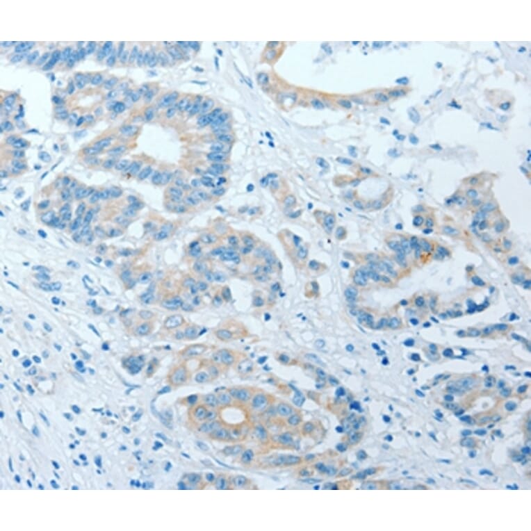 Immunohistochemistry - AKAP7 Antibody from Signalway Antibody (36067) - Antibodies.com