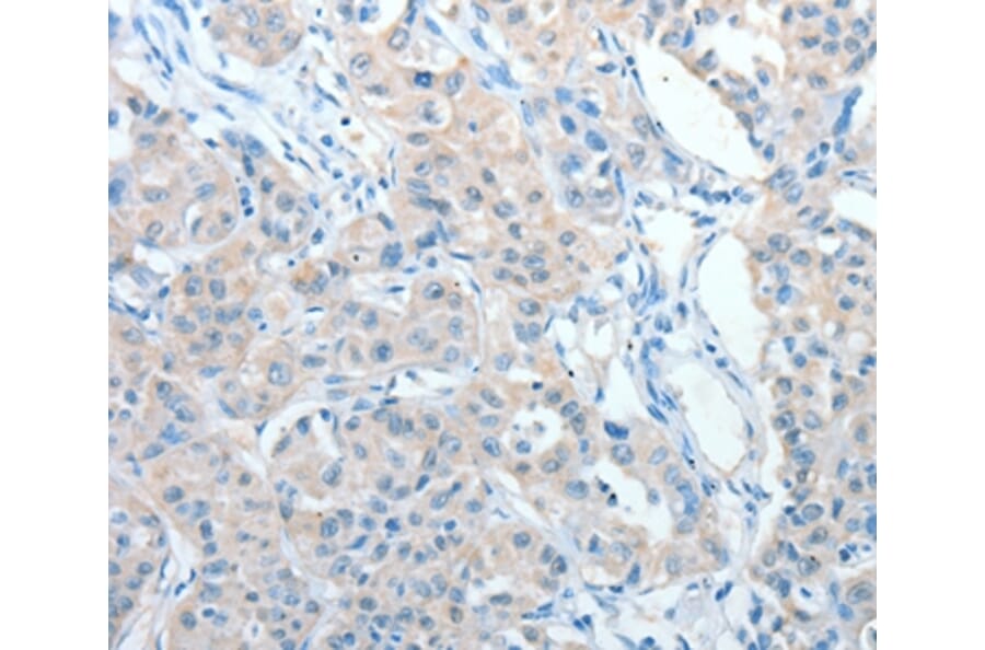 Immunohistochemistry - AKAP9 Antibody from Signalway Antibody (36069) - Antibodies.com