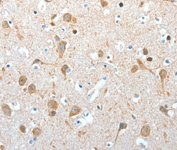 Immunohistochemical analysis of paraffin-embedded Human brain tissue using #36070 at dilution 1/10.