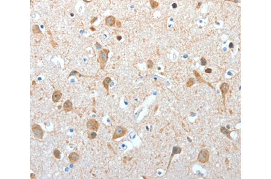 Immunohistochemistry - AKAP4 Antibody from Signalway Antibody (36070) - Antibodies.com