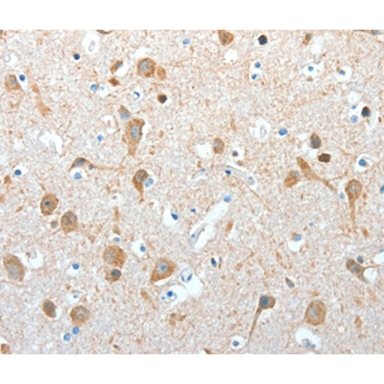 Immunohistochemistry - AKAP4 Antibody from Signalway Antibody (36070) - Antibodies.com