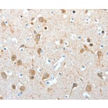 Immunohistochemistry - AKAP4 Antibody from Signalway Antibody (36070) - Antibodies.com