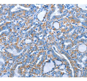 Immunohistochemistry - ALAS1 Antibody from Signalway Antibody (36073) - Antibodies.com
