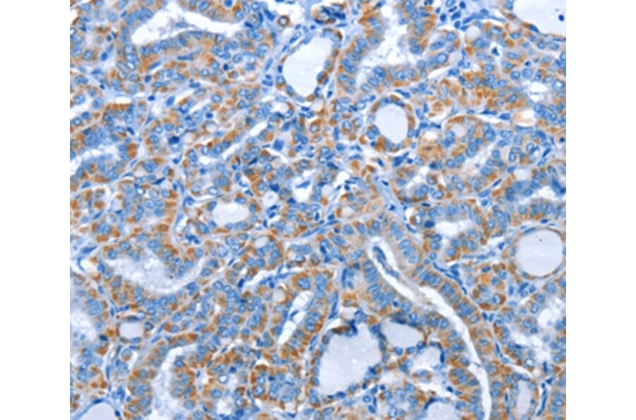 Immunohistochemistry - ALAS1 Antibody from Signalway Antibody (36073) - Antibodies.com