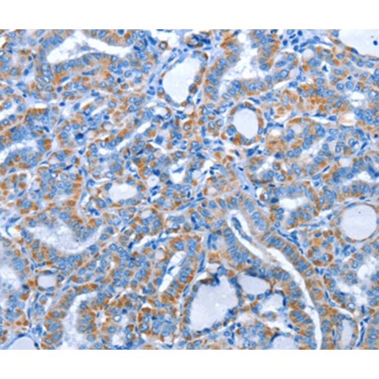 Immunohistochemistry - ALAS1 Antibody from Signalway Antibody (36073) - Antibodies.com