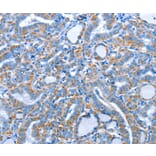 Immunohistochemistry - ALAS1 Antibody from Signalway Antibody (36073) - Antibodies.com