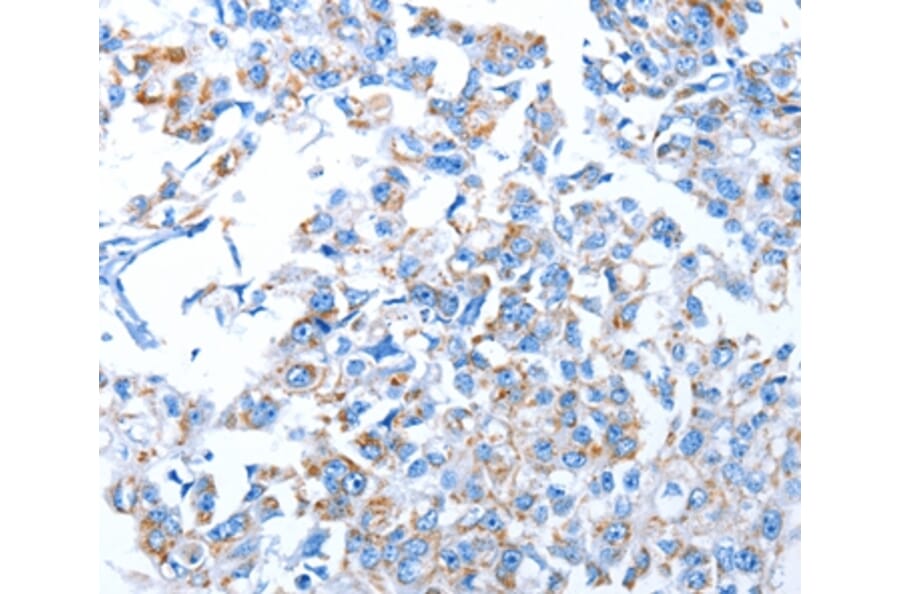 Immunohistochemistry - ALAS1 Antibody from Signalway Antibody (36073) - Antibodies.com