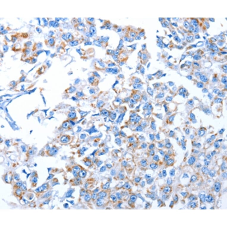 Immunohistochemistry - ALAS1 Antibody from Signalway Antibody (36073) - Antibodies.com