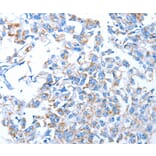 Immunohistochemistry - ALAS1 Antibody from Signalway Antibody (36073) - Antibodies.com