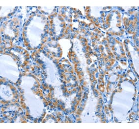 Immunohistochemistry - ALPK1 Antibody from Signalway Antibody (36086) - Antibodies.com