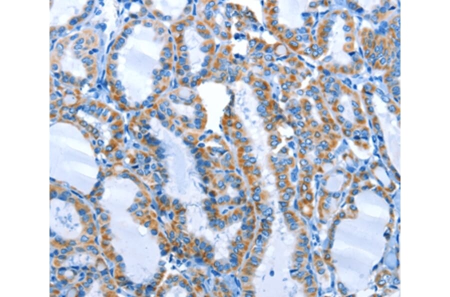 Immunohistochemistry - ALPK1 Antibody from Signalway Antibody (36086) - Antibodies.com