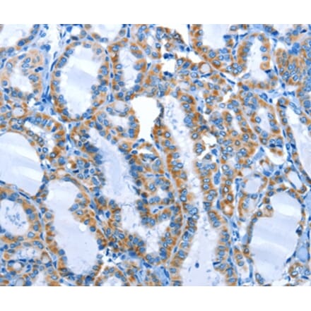 Immunohistochemistry - ALPK1 Antibody from Signalway Antibody (36086) - Antibodies.com