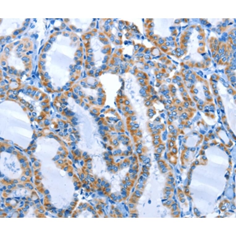 Immunohistochemistry - ALPK1 Antibody from Signalway Antibody (36086) - Antibodies.com