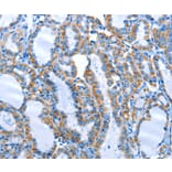 Immunohistochemistry - ALPK1 Antibody from Signalway Antibody (36086) - Antibodies.com