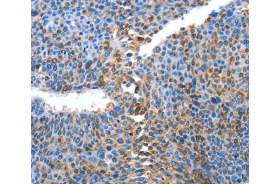 Immunohistochemistry - ALPK1 Antibody from Signalway Antibody (36086) - Antibodies.com