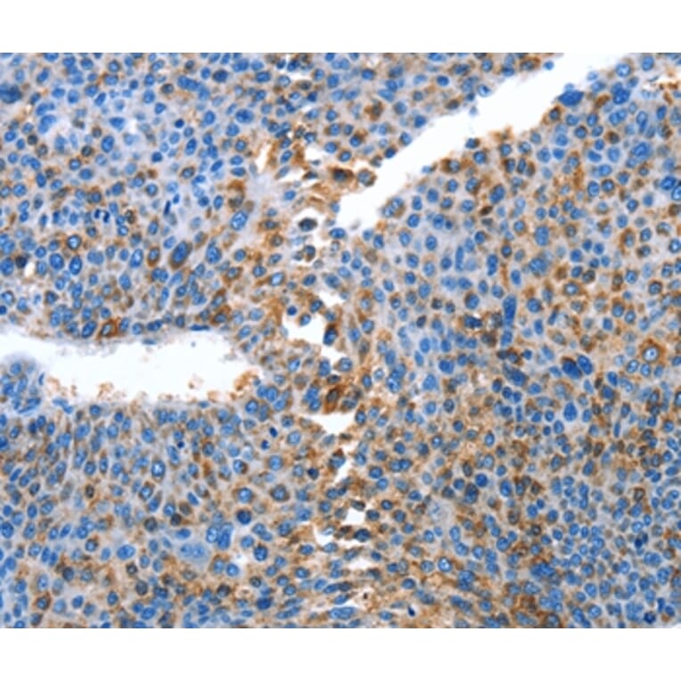 Immunohistochemistry - ALPK1 Antibody from Signalway Antibody (36086) - Antibodies.com