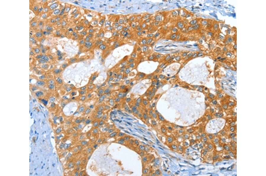 Immunohistochemistry - AMHR2 Antibody from Signalway Antibody (36093) - Antibodies.com