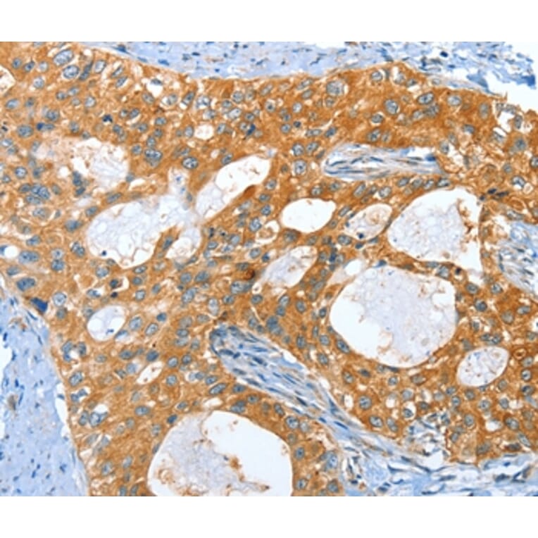 Immunohistochemistry - AMHR2 Antibody from Signalway Antibody (36093) - Antibodies.com