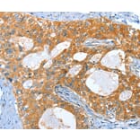 Immunohistochemistry - AMHR2 Antibody from Signalway Antibody (36093) - Antibodies.com