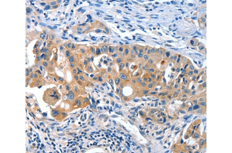 Immunohistochemistry - AMHR2 Antibody from Signalway Antibody (36093) - Antibodies.com