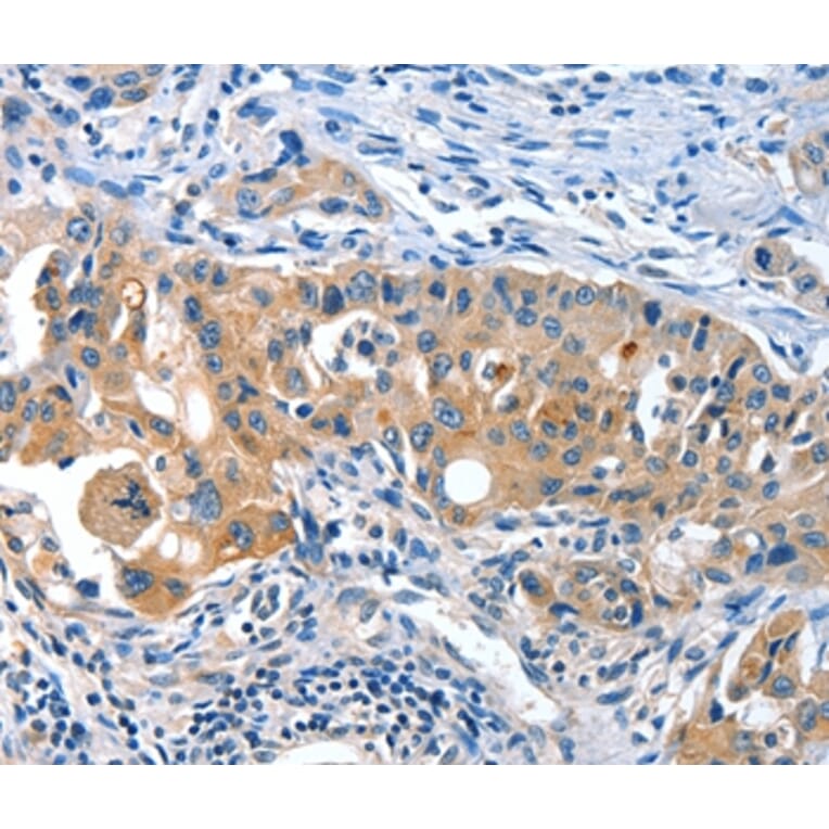 Immunohistochemistry - AMHR2 Antibody from Signalway Antibody (36093) - Antibodies.com