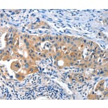 Immunohistochemistry - AMHR2 Antibody from Signalway Antibody (36093) - Antibodies.com