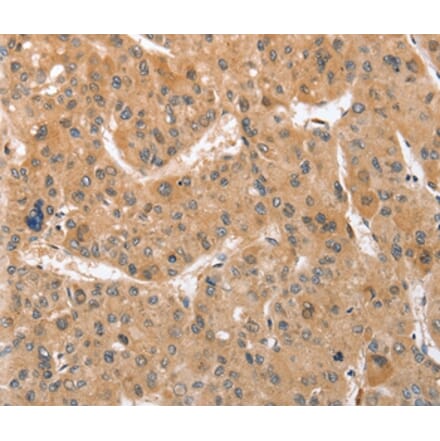 Immunohistochemistry - ATG12 Antibody from Signalway Antibody (36117) - Antibodies.com
