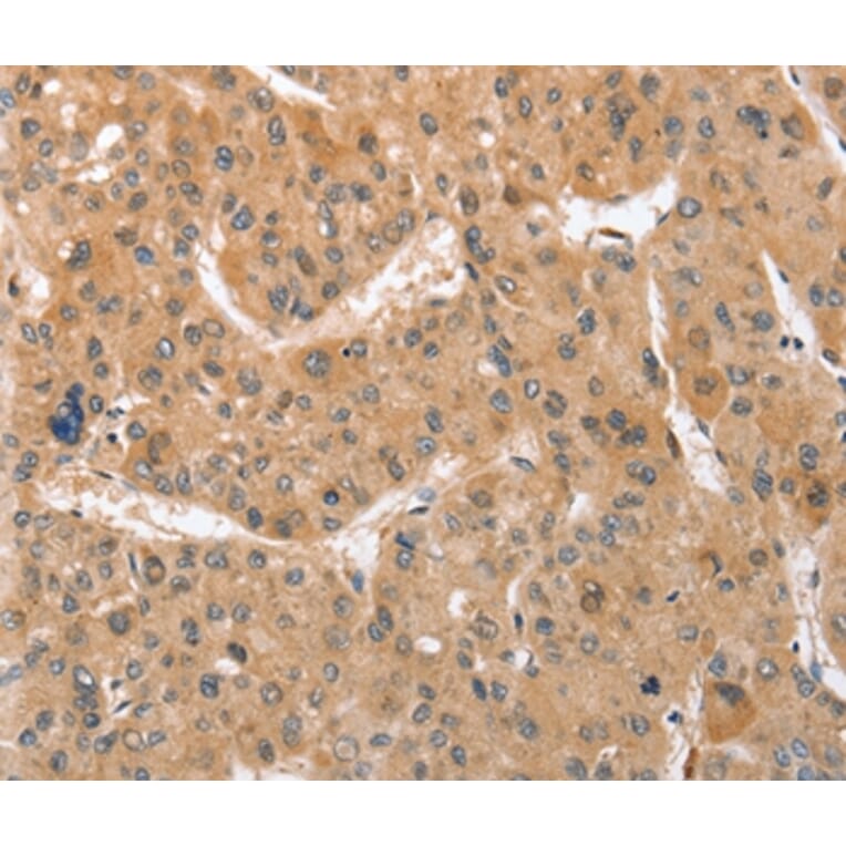 Immunohistochemistry - ATG12 Antibody from Signalway Antibody (36117) - Antibodies.com