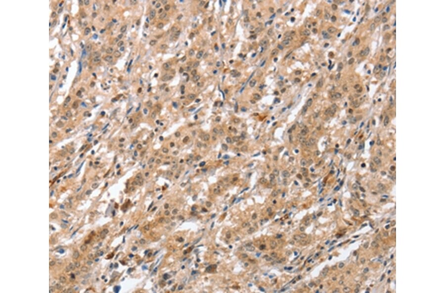 Immunohistochemistry - ATG12 Antibody from Signalway Antibody (36117) - Antibodies.com