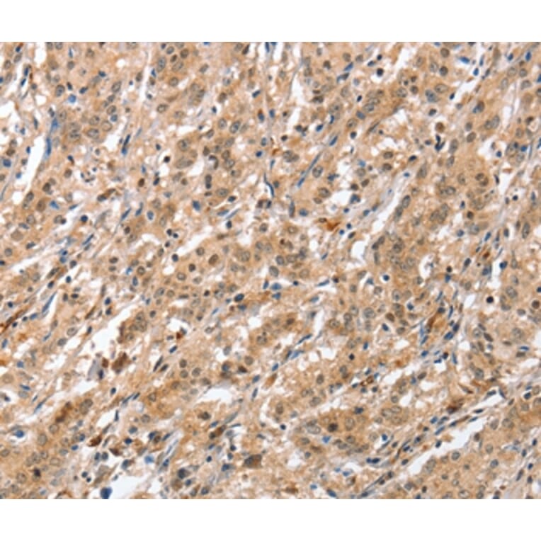 Immunohistochemistry - ATG12 Antibody from Signalway Antibody (36117) - Antibodies.com