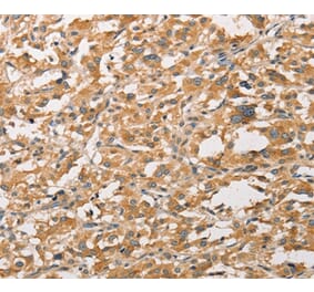 Immunohistochemistry - WNT11 Antibody from Signalway Antibody (36136) - Antibodies.com