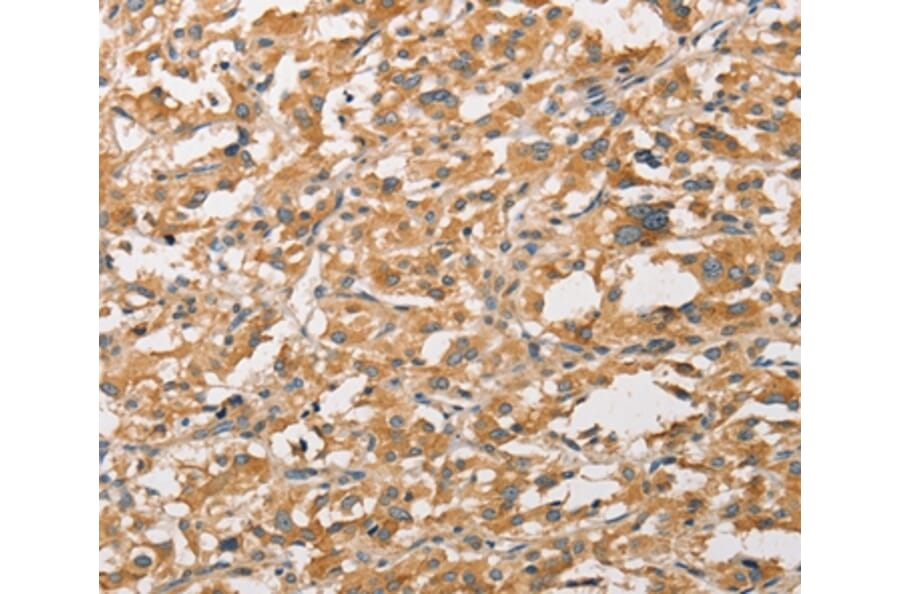 Immunohistochemistry - WNT11 Antibody from Signalway Antibody (36136) - Antibodies.com