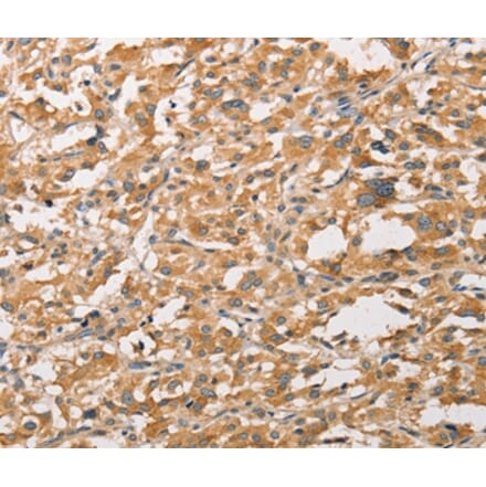 Immunohistochemistry - WNT11 Antibody from Signalway Antibody (36136) - Antibodies.com
