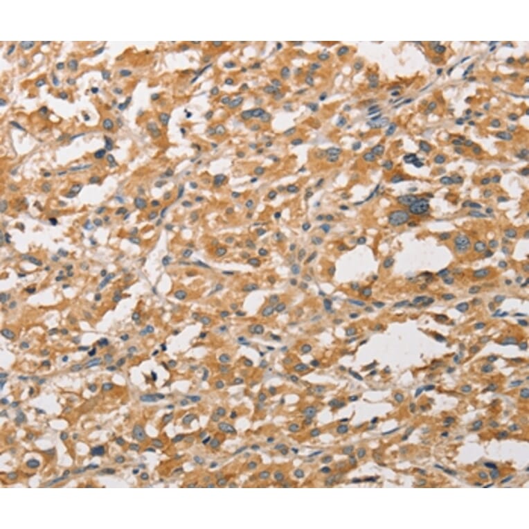 Immunohistochemistry - WNT11 Antibody from Signalway Antibody (36136) - Antibodies.com