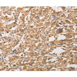 Immunohistochemistry - WNT11 Antibody from Signalway Antibody (36136) - Antibodies.com