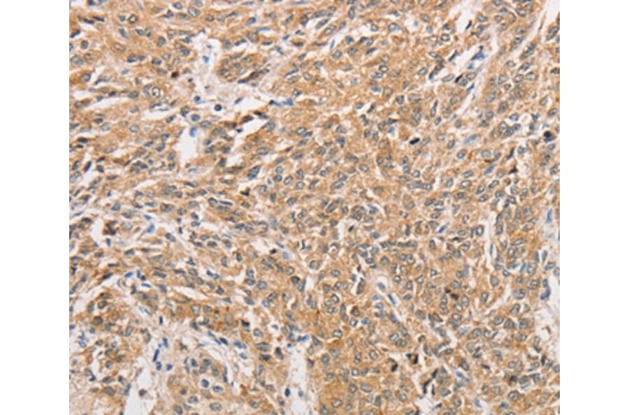 Immunohistochemistry - WNT11 Antibody from Signalway Antibody (36136) - Antibodies.com
