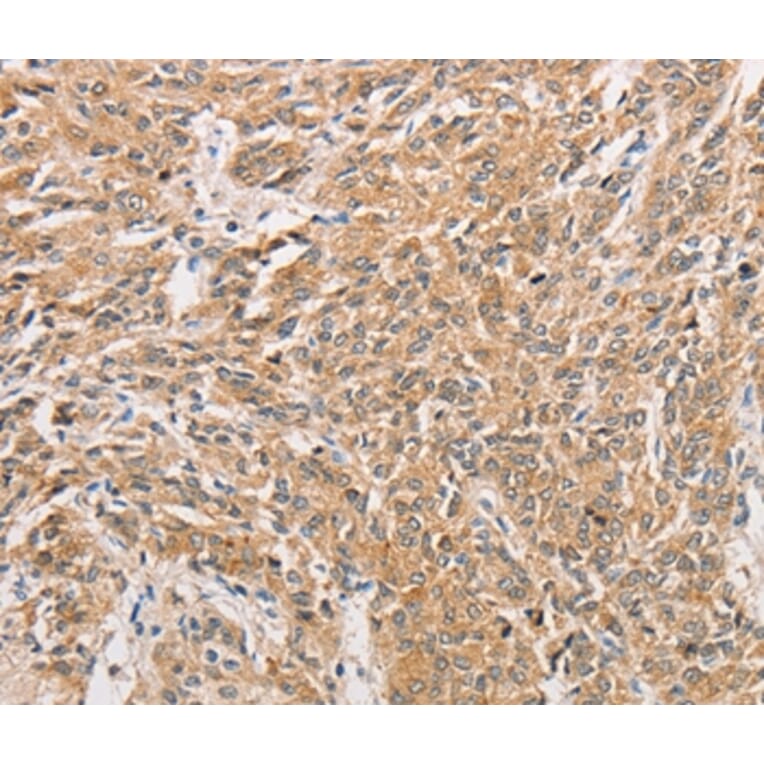 Immunohistochemistry - WNT11 Antibody from Signalway Antibody (36136) - Antibodies.com